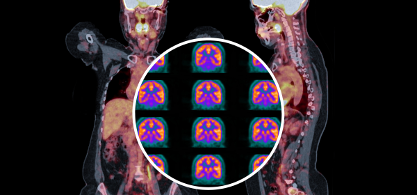 medical imaging - full body and brain overlay image