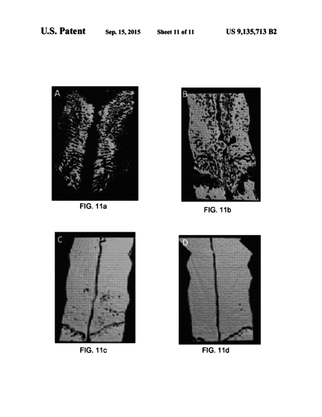 Automated Medical Image Interpretation for Tissue Segmentation