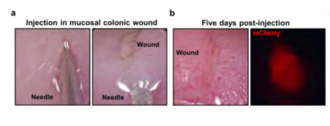 A image is of injection into mucosal colonic wound. B image of wound 5 day post-injection 