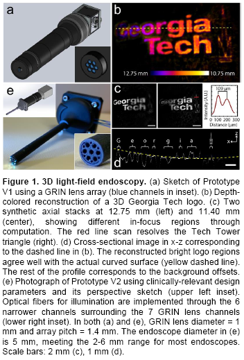 endoscope