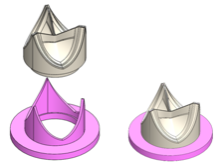 Three illustrated valve geometries with round bases and three upward pointing leaves showing the beige leaflet portion separate from a purple base. 
