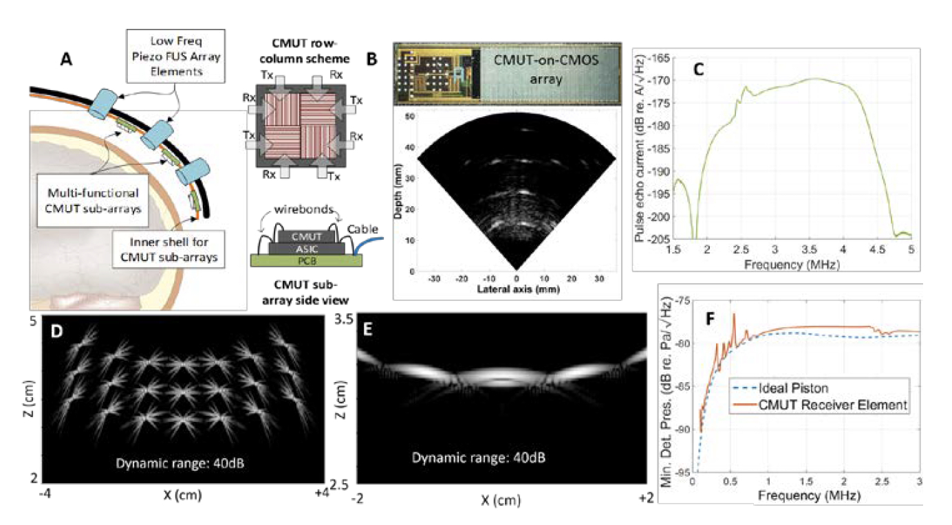 Multi-Functional Sparse Phased Arrays for Guiding Focused Ultrasound Therapies