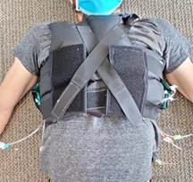 Vest-Style Device Assists Ventilation and Perfusion (V/Q) to Prevent Respiratory Failure