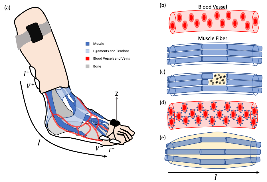 Wearable Device for Evaluating Post-Injury Ankle Health During Ambulation