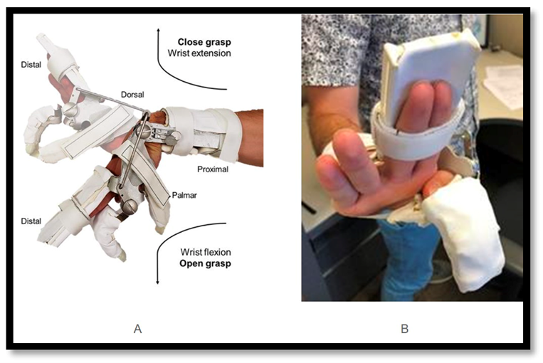 A Partial-Hand Prosthesis Simulator