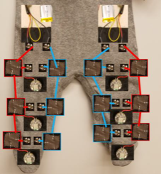 High-Tech Infant Suit for Earlier Detection of Cerebral Palsy