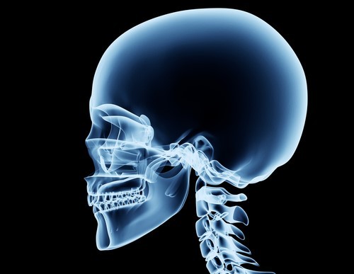 x-ray image of a skull