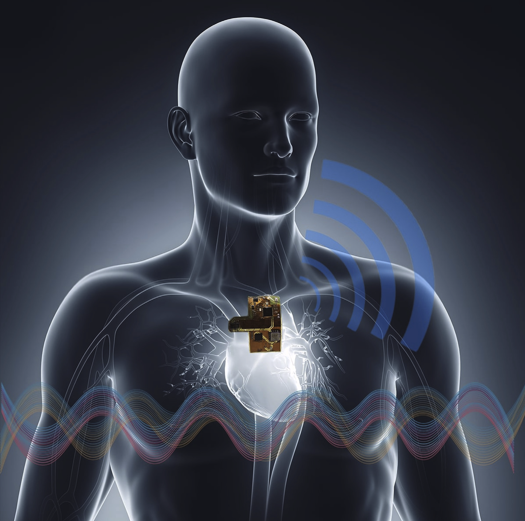 Outline of a human upper body showing the heart and arteries overlaid with a rectangular electronic device. 